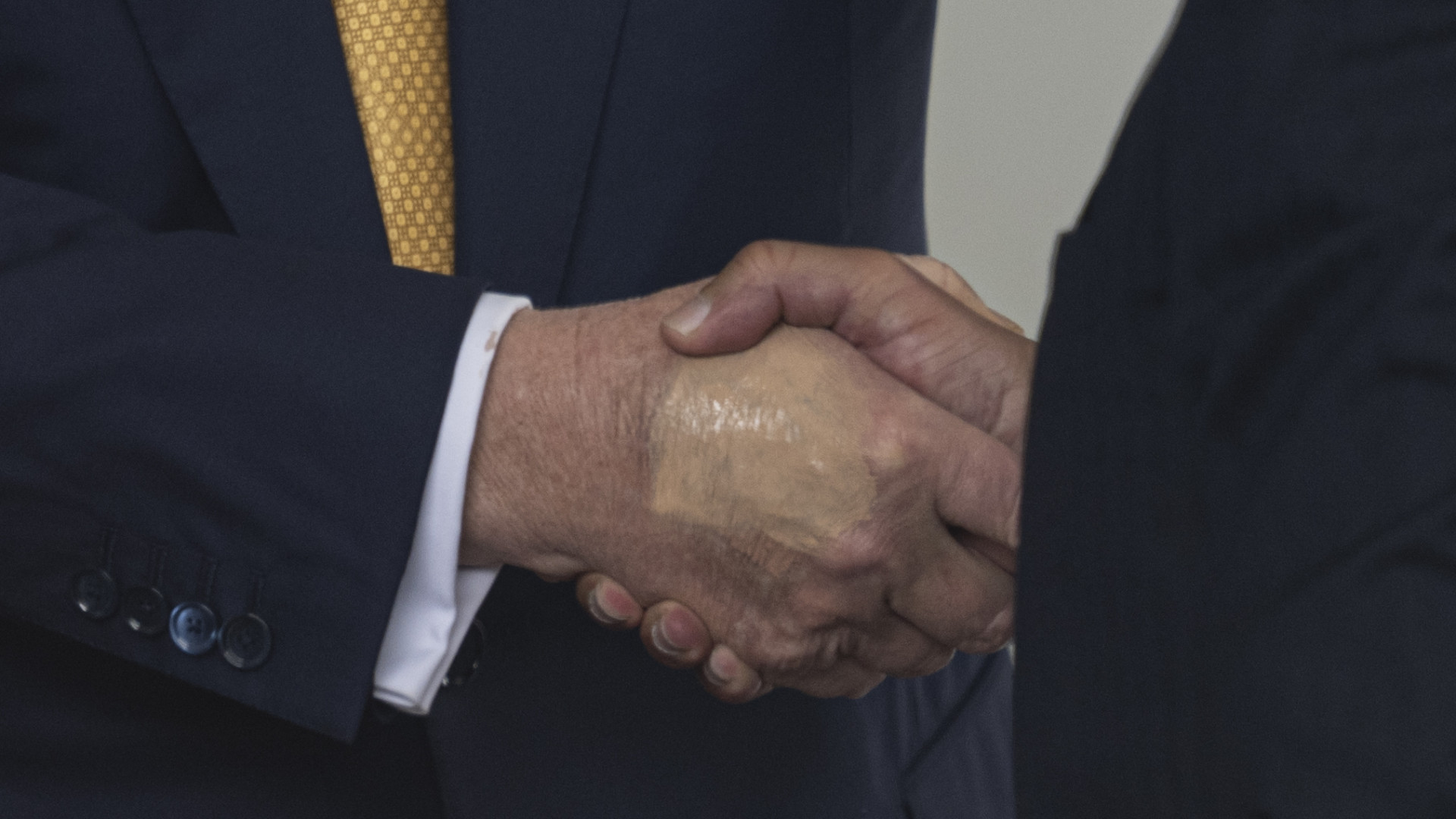 Bejelentette a Fehér Ház: krónikus beteg Donald Trump – Forrás: Portfolio.hu