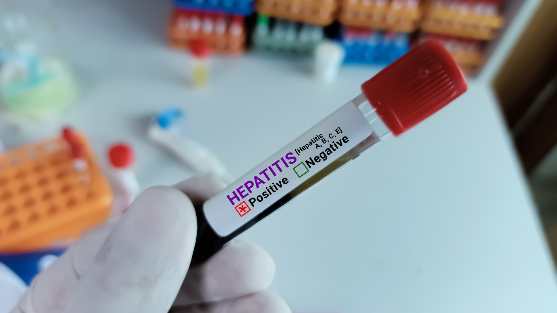 A new epidemic is on the rise in Hungary too, but what will be its course?