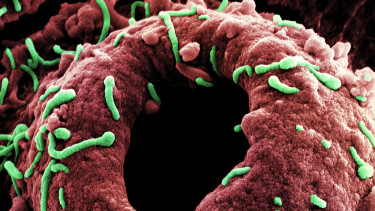 Megszólalt a virológus: Európa sincs teljes biztonságban a 60-70%-ban halálos kórral szemben