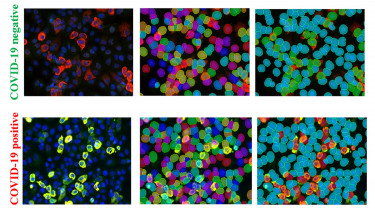 Koronavírus teszt - Eötvös Loránd Kutatási Hálózat Titkársága